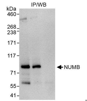 Rabbit NUMB Antibody