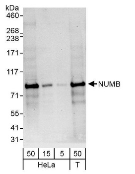 Rabbit NUMB Antibody