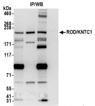 ROD/KNTC1 Antibody