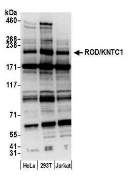 Rabbit ROD/KNTC1 Antibody