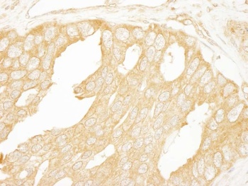 Rabbit BRAF Antibody