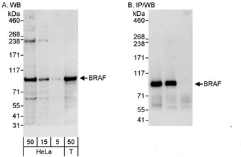 Rabbit BRAF Antibody