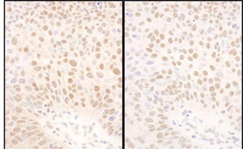 Rabbit anti-BMI1 Antibody