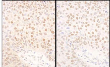 BMI1 Antibody