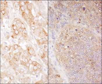 Rabbit eEF2 Antibody
