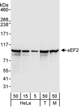 Rabbit eEF2 Antibody