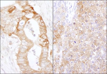 Rabbit anti-eEF2 Kinase Antibody