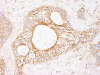 Rabbit anti-eEF2 Kinase Antibody