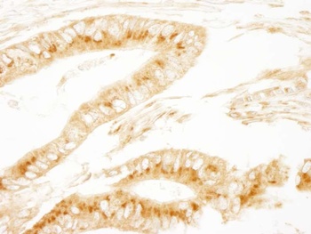 Rabbit anti-PRKAR2A/PKA-RIIalpha Antibody