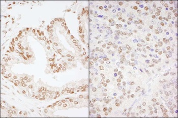 Rabbit CREB Antibody