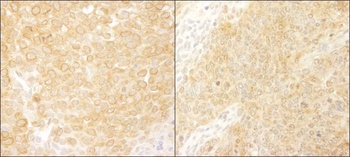 Rabbit BCAR1/p130CAS Antibody