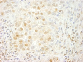 Rabbit anti-PRPF4B Antibody
