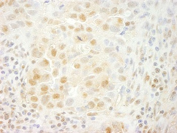 PRPF4B Antibody