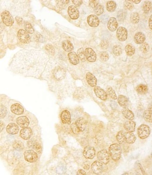 Rabbit anti-ANKRD17 Antibody