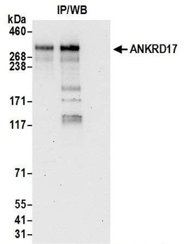 ANKRD17 Antibody
