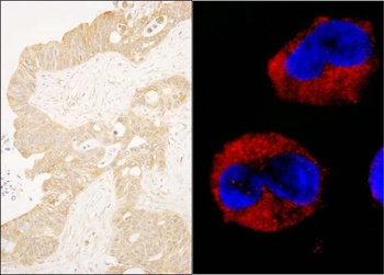 Rabbit anti-cAbl Antibody