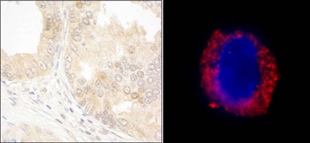 Rabbit anti-cAbl Antibody