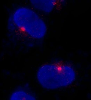 Rabbit anti-CEP290 Antibody