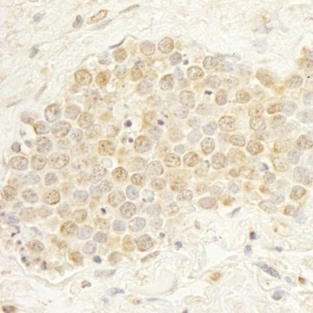 Rabbit anti-WDR20 Antibody