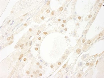 Rabbit B-Myb Antibody