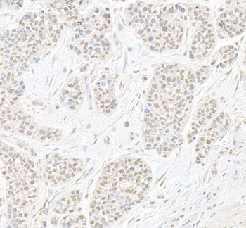 Rabbit B-Myb Antibody