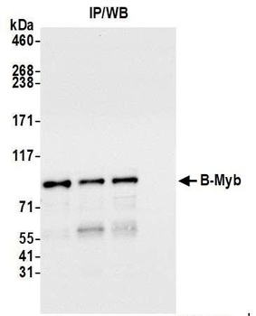 Rabbit B-Myb Antibody