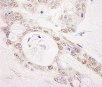 Rabbit anti-PUS1 Antibody