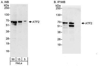 Rabbit ATF2 Antibody