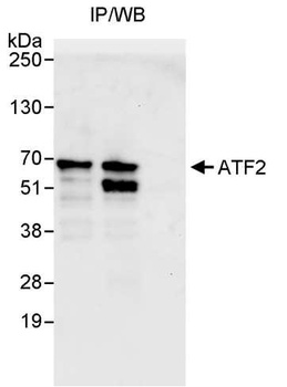 Rabbit ATF2 Antibody