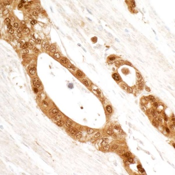 Rabbit 14-3-3 Sigma Antibody