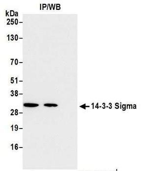 Rabbit 14-3-3 Sigma Antibody