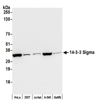 Rabbit 14-3-3 Sigma Antibody