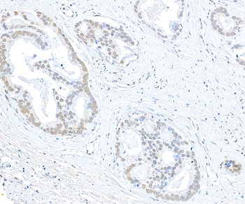 Rabbit anti-EHMT1 Antibody