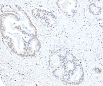 EHMT1 Antibody