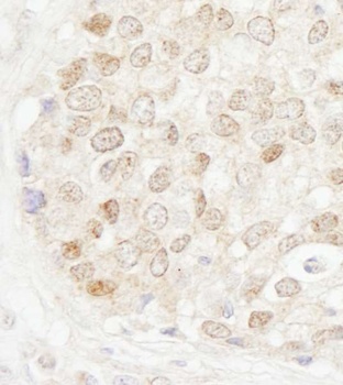 MBD4 Antibody