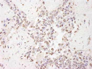 Rabbit MBD2 Antibody