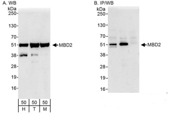 Rabbit MBD2 Antibody