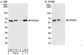Rabbit anti-KPNA3 Antibody