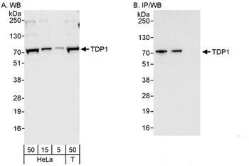 Rabbit anti-TDP1 Antibody