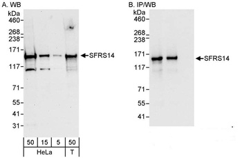 Rabbit anti-SFRS14 Antibody