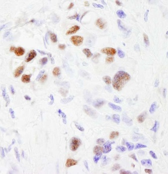 Rabbit SF3b145/SAP145 Antibody