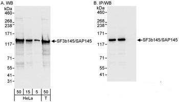 SF3b145/SAP145 Antibody