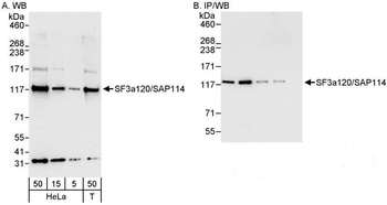 Rabbit SF3a120/SAP114 Antibody