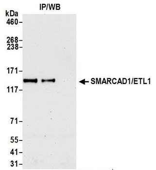 SMARCAD1/ETL1 Antibody
