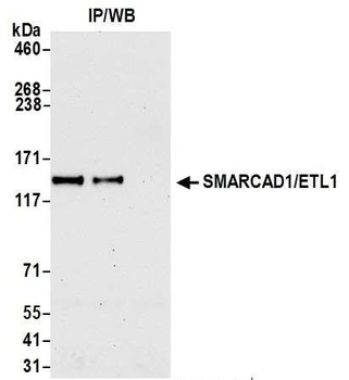 Rabbit anti-SMARCAD1/ETL1 Antibody