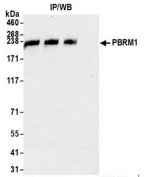 PBRM1 Antibody