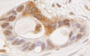 Rabbit OSR1 Antibody