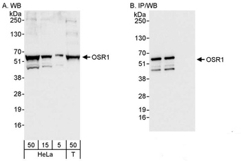 Rabbit OSR1 Antibody