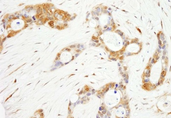 Rabbit OSR1 Antibody