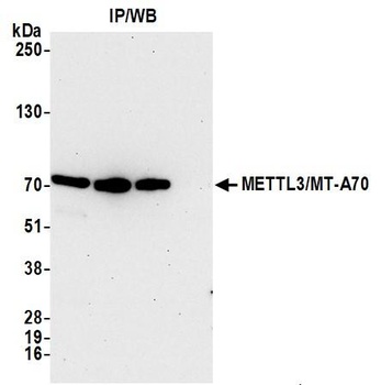 METTL3/MT-A70 Antibody